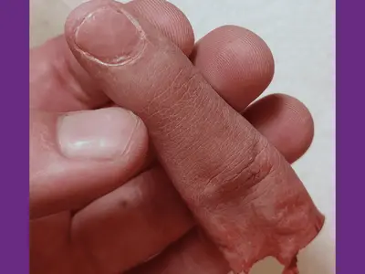 Close up of a white hand holding a severed latex finger.
